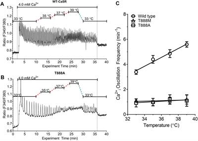 Temperature sensing by the calcium-sensing receptor
